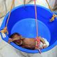 A Yemeni child suffering from severe malnutrition is weighed at a hospital in Yemen's northwestern Hajjah province