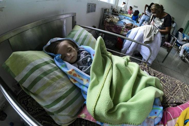 An undernourished baby in a hospital bed in Maracay, Aragua state, Venezuela on February 7, 2019