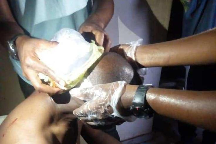 Referee beaten up by angry fans over his officiating in a NPFL match