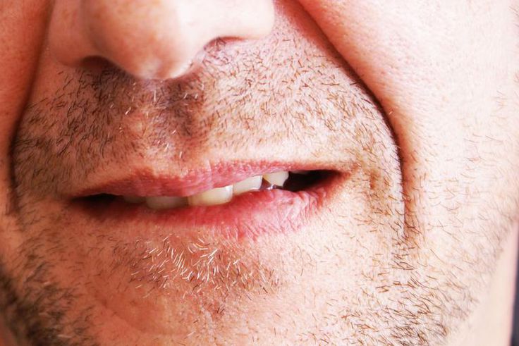 How To Get Rid of a Pimple On Your Lip