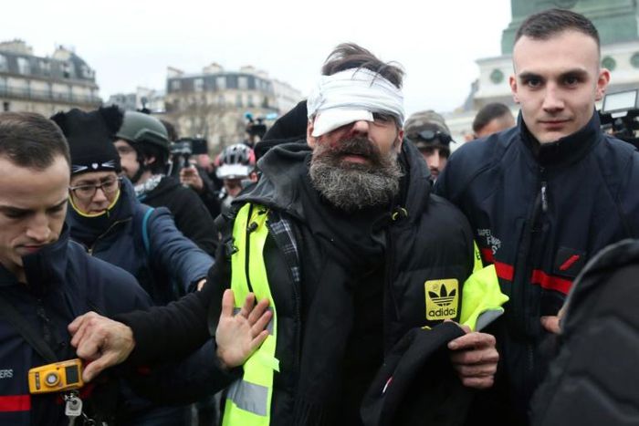 Jerome Rodrigues, who has become a well-known figure in the "yellow vest" movement with 50,000 followers on Facebook, was live-streaming the protest on the website when he was hit
