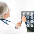 Closing In on Alzheimer's Disease