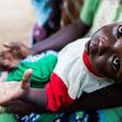 Hunger has stalked South Sudan for years, driven by the country's disastrous civil war