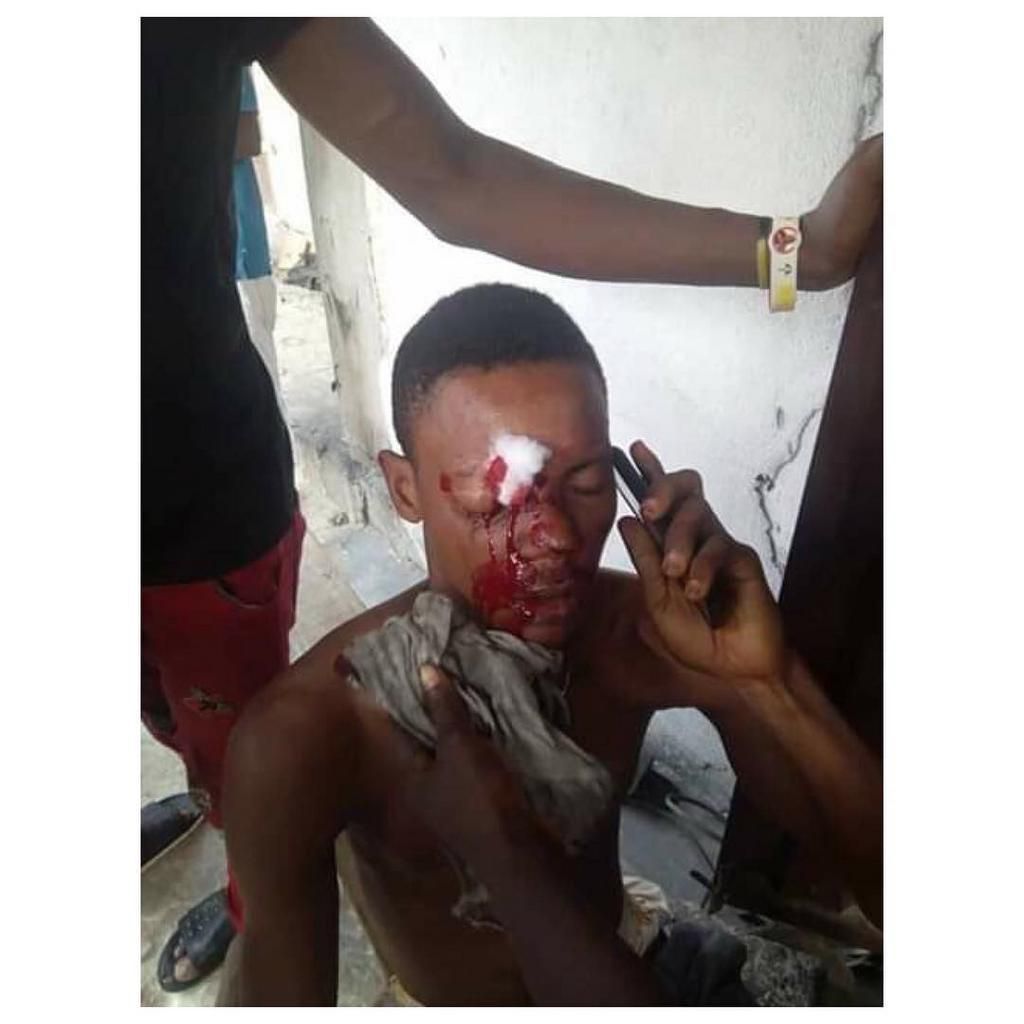 Abeulah was rushed to the hospital following the incident