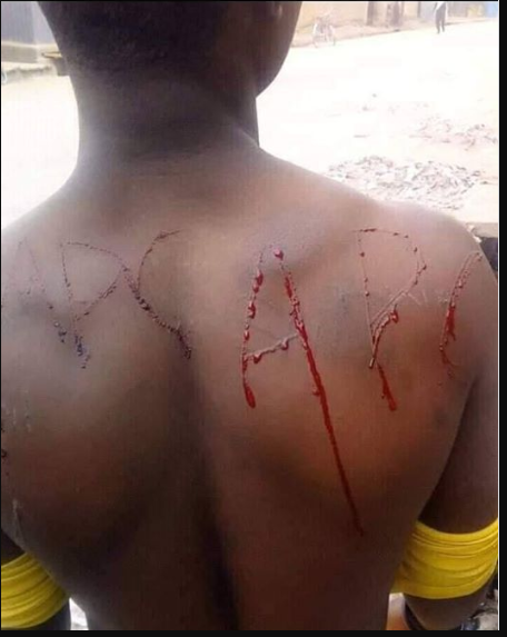 APC supporter inscribe the party's acronym on his skin