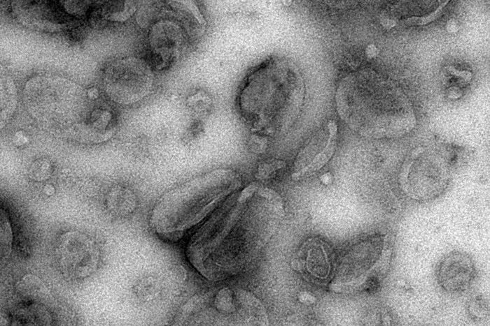 Cancer's Trick for Dodging the Immune System