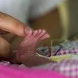 The survival rate of the smallest babies is substantially lower for boys compared with girls
