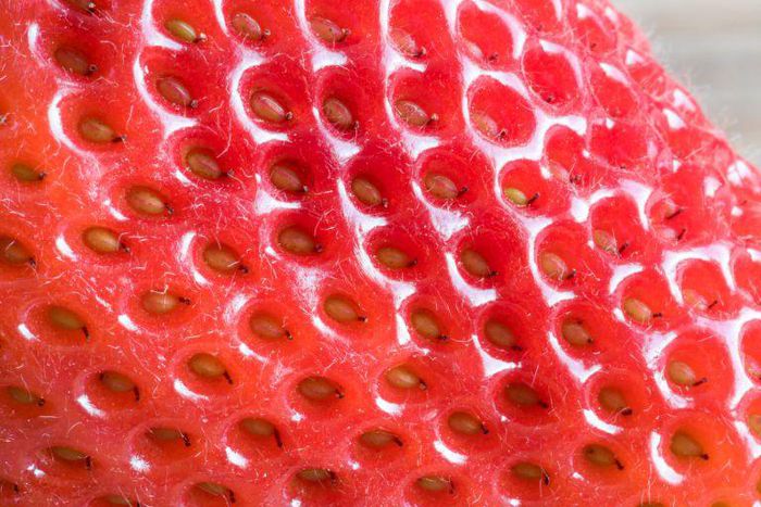 See Dr. Pimple Popper Remove Several Blackheads