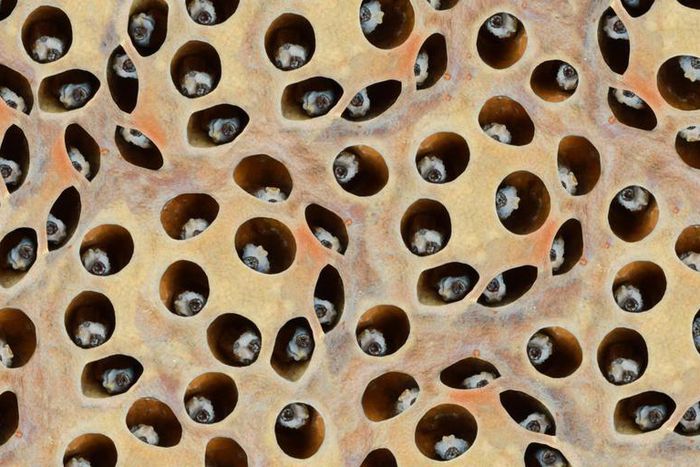 Dr. Pimple Popper Goes Ham on a Blackhead Bonanza