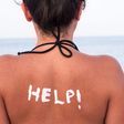 This Sunburn Relief Plan Is Here To Save Your Skin