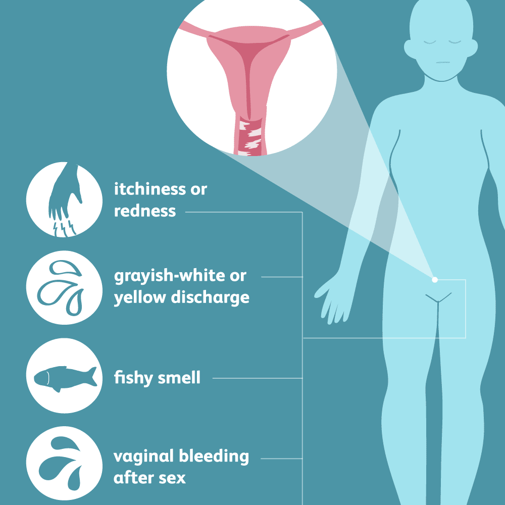 These are the symptoms of Bacterial Vaginosis