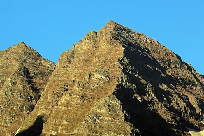 Dr. Pimple Popper Pops Three Huge Scalp Cysts