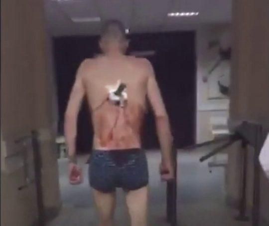 Nurses at a hospital in Russia were surprised when they saw a patient with a knife lodged in his back walking out of the health center to smoke a cigarette though he didn't have any on him. [Metro UK]