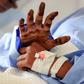 A Yemeni girl receives treatment at a hospital in the capital Sanaa for wounds sustained during an air strike in northern Hajjah province