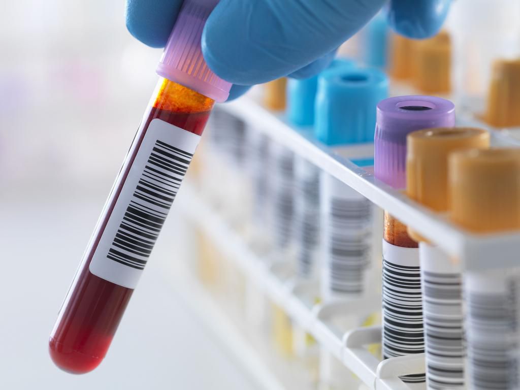 Blood Sample Tested for HIV