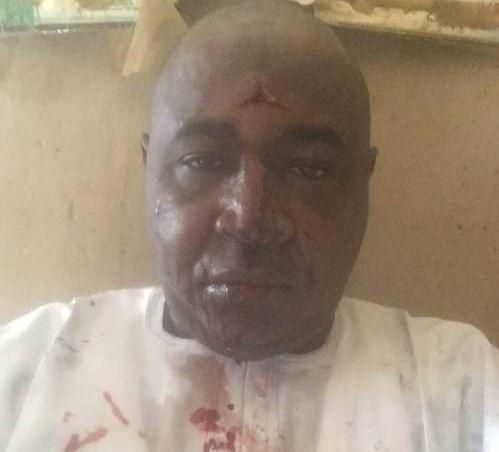 The voter was admitted in a hospital for three hours to receive stitches after getting attacked by thugs. [LIB]