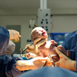 A baby delivered through Caesarean section  [ndanitv]