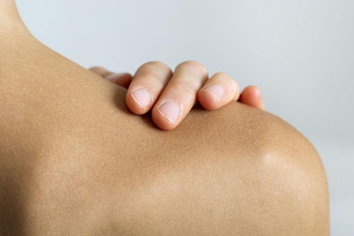 Dr. Pimple Popper Removes Huge Shoulder Lipoma