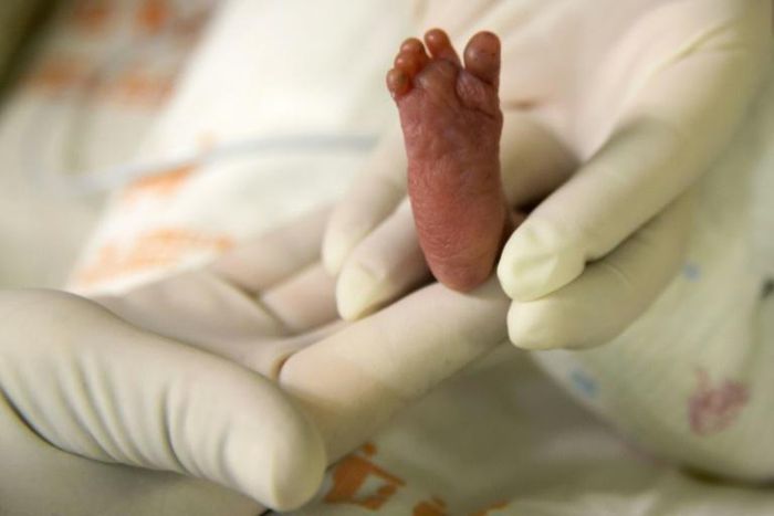 At 23 weeks, doctors deemed the 11-year-old girl to be in danger but instead of an abortion, they performed a caesarean section, and they say the five-month-old fetus has almost no chance of surviving