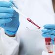 Second HIV Patient Has Been "Cured" of the Diseae