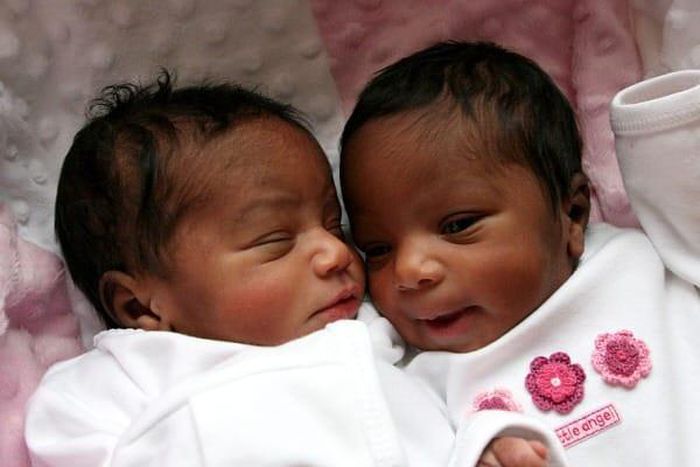 Cheating wife gives birth to twins with different fathers