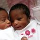 Cheating wife gives birth to twins with different fathers