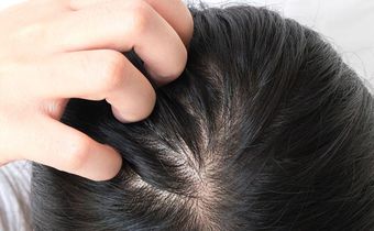 14 Best Shampoos For Thinning Hair