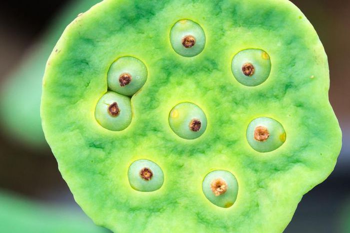 Dr. Pimple Popper Summons Pus Out of Blackheads