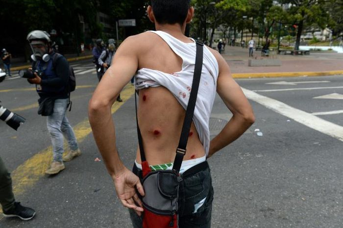 A wounded Venezuelan protester shows his back as riot police clash with demonstrators opposing the government of President Nicolas Maduro in Caracas on January 23, 2019 -- Amnesty says the government may have committed "crimes against humanity"