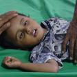 Children under five make up nearly a third of new Cholera cases in Yemen this year, according to the UN