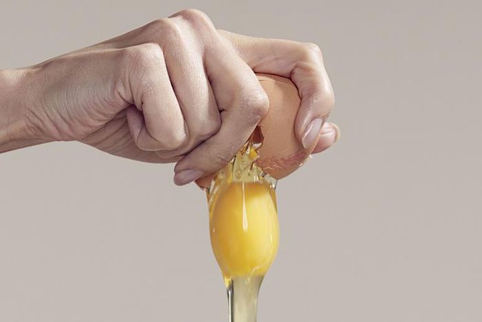 Dr. Pimple Popper Pops Steatocystoma On Man's Head