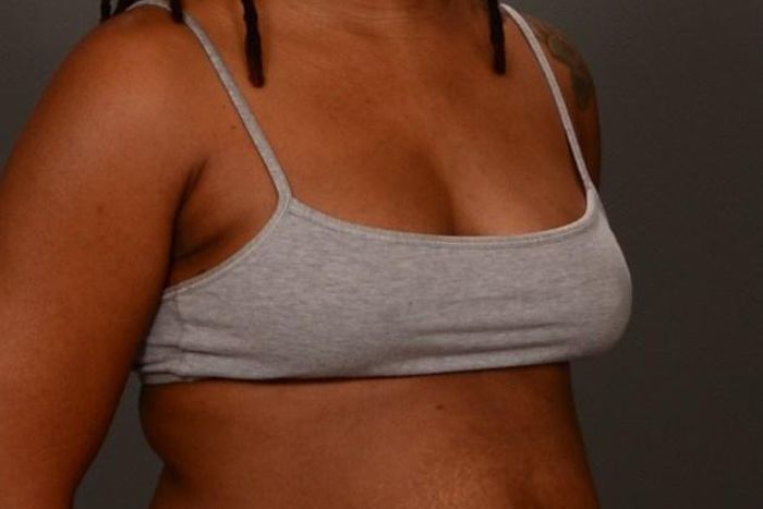 All about postpartum diastasis recti and how to get rid of it [Credit: The Birth Hour]