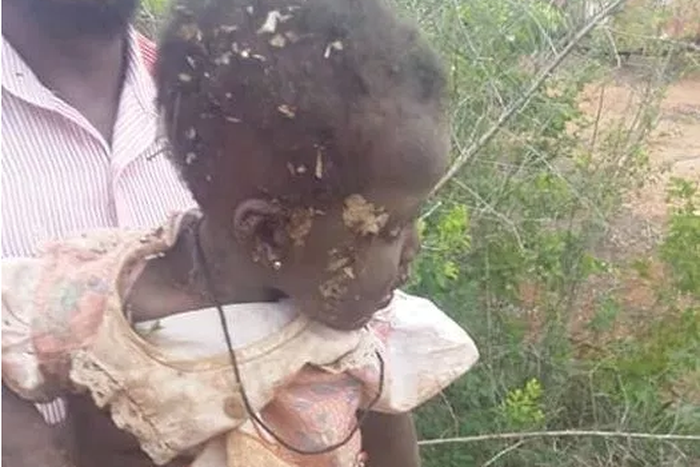 10-month-old baby girl rescued in Ghana after being buried alive by her mother