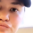 Chrissy Teigen's Tooth Fell Out