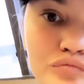 Chrissy Teigen's Tooth Fell Out
