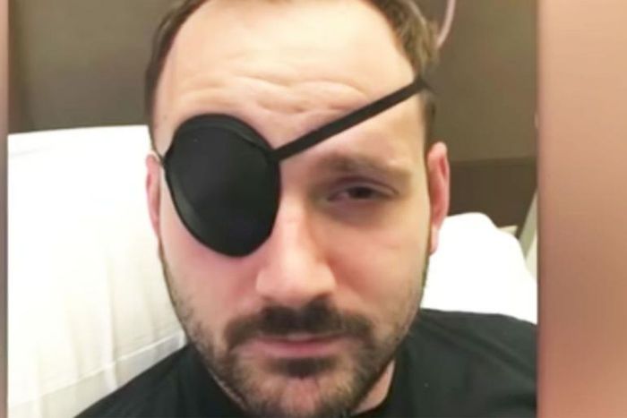 Man Suffers a Stroke After Popping His Neck