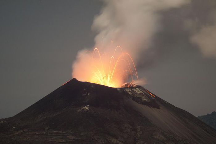 Dr. Pimple Popper Pops a Cyst Above a Man's Eye