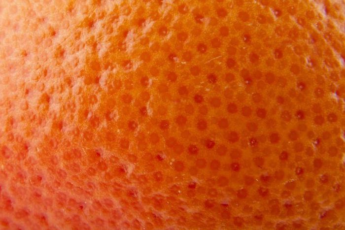 The Best Cellulite Treatments