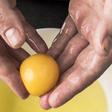 We Can't Stop Watching This Lipoma Extraction