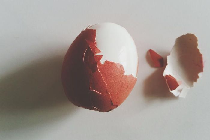 Dr. Pimple Popper Removes Egg-Shaped Cyst