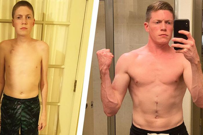This Man Managed Crohn's Disease and Got Strong