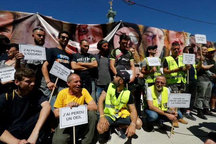 Between 300 and 400 people took part in what they called a 'march of the mutilated' in Paris Sunday