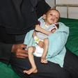 A malnourished child receiving treatment at a hospital in Yemen: a UN report said more than 821 million people worldwide suffered from hunger in 2018