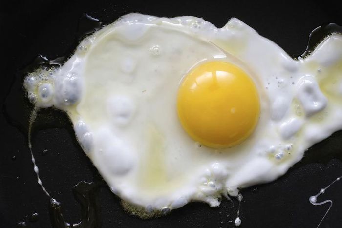 This PIlar Cyst Looks Like an Egg Yolk