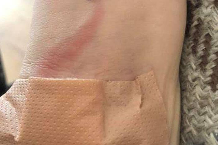 Mom Saves Son's Life By Recognizing Sepsis Signs