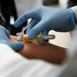 A technician extracts blood from a patient for an HIV test at the specialized Condesa Clinic in Mexico City on July 18, 2019, three days before the opening in the city of an international conference on HIV science