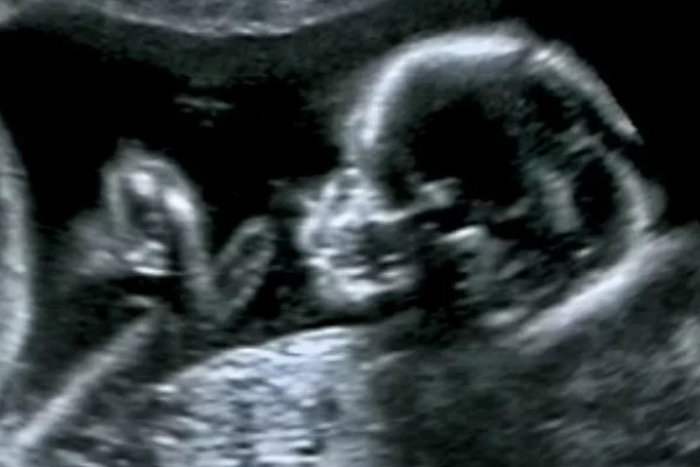 Wondering how to use a pregnancy test strip?