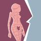 Here's how you know if you have a yeast infection and how to treat it [Credit: Health Magazine]