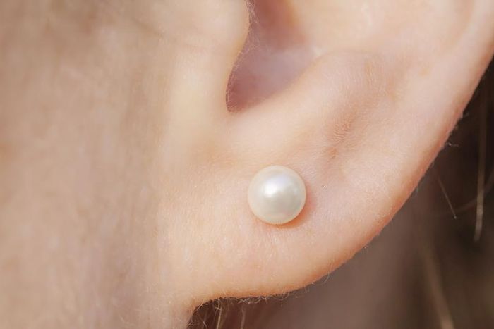 Dr. Pimple Popper Removed Blackhead On Earlobe