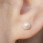 Dr. Pimple Popper Removed Blackhead On Earlobe